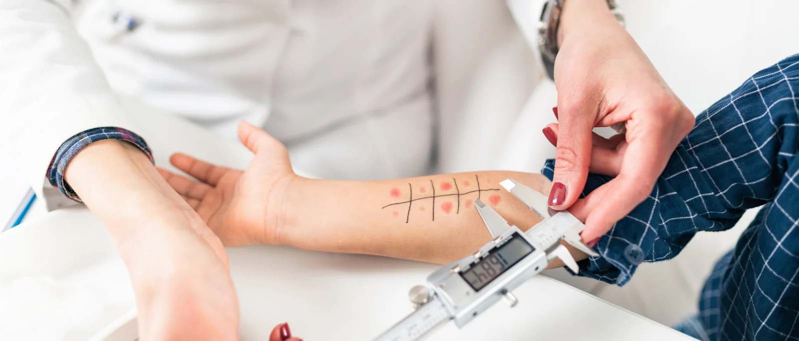 Kuo skiriasi alergologas nuo alergologo - klinikinio imunologo