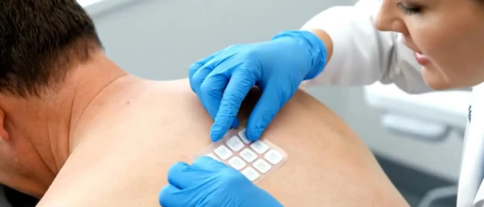 Išplėstinis aplikacinis odos lopo mėginys su 34 dažniausiai odontologijoje naudojamomis medžiagomis